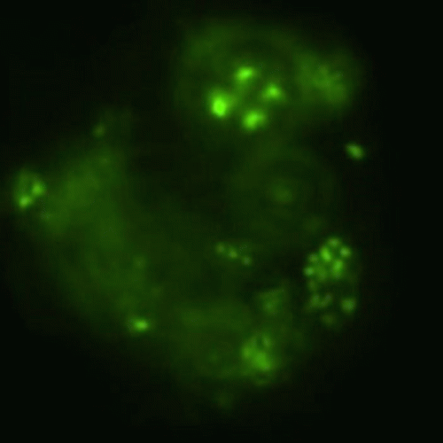 Parasitic Equilibrium : Bottom of the Ocean Bliss